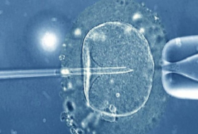Three-person IVF baby for infertile couple